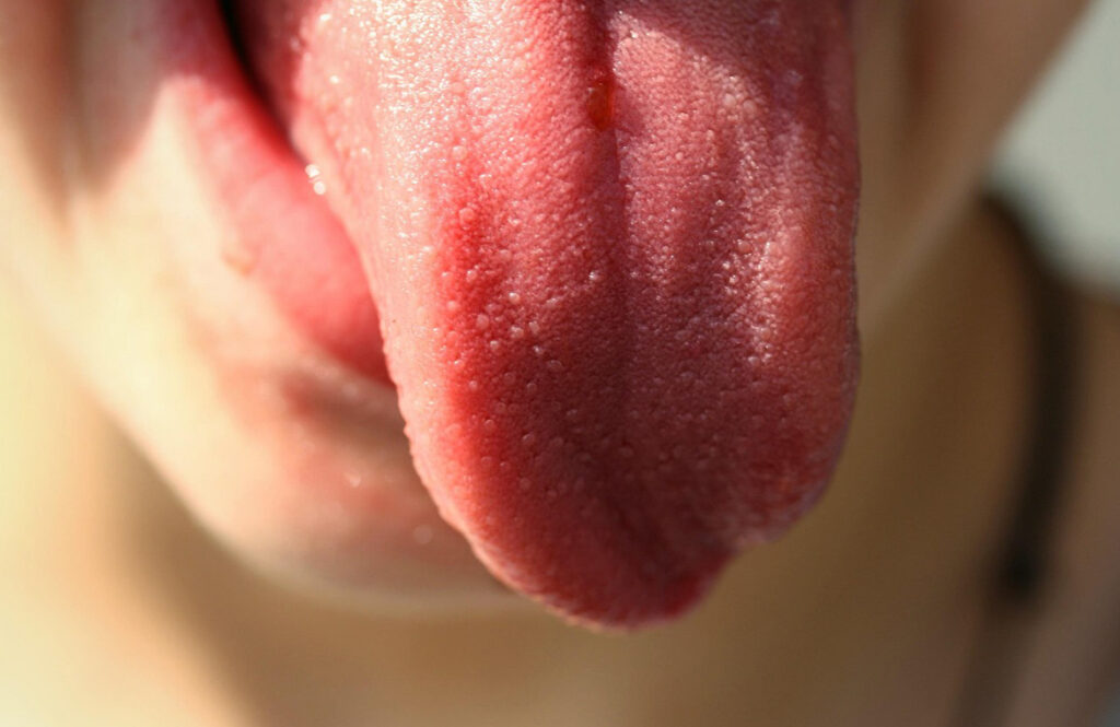 Esto es lo que tu lengua puede decir de tu salud