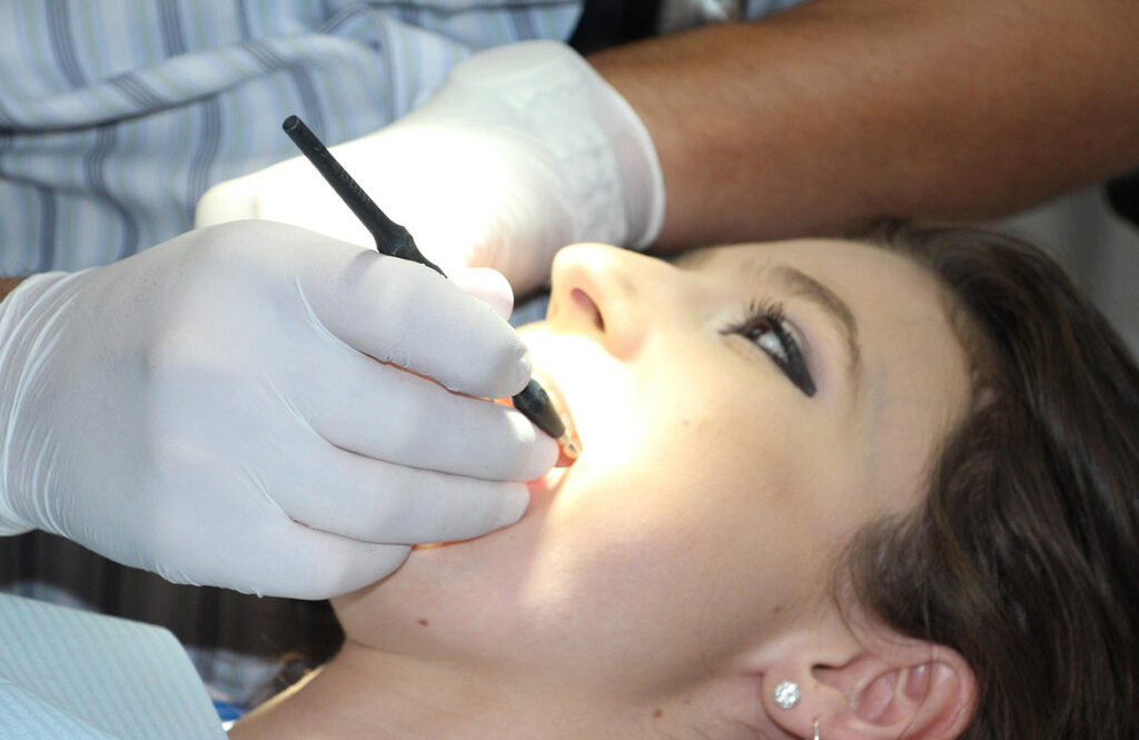 Blanqueamiento dental, ¿puede perjudicarte?